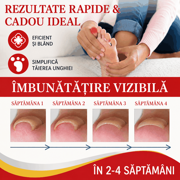 Soluție pentru Îngrijirea Unghiilor Încarnate